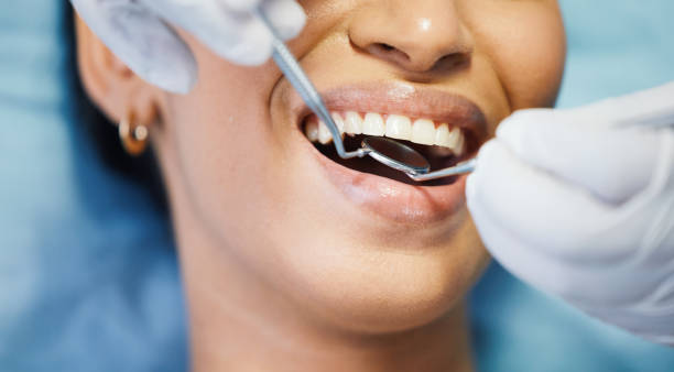 Best Emergency Dentist for Special Needs Patients in Syracuse, UT